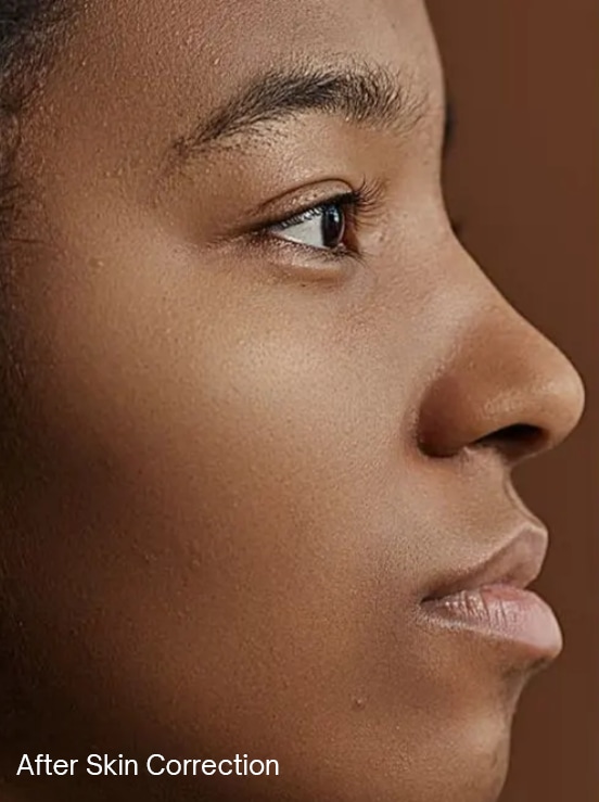 Skin correction, before